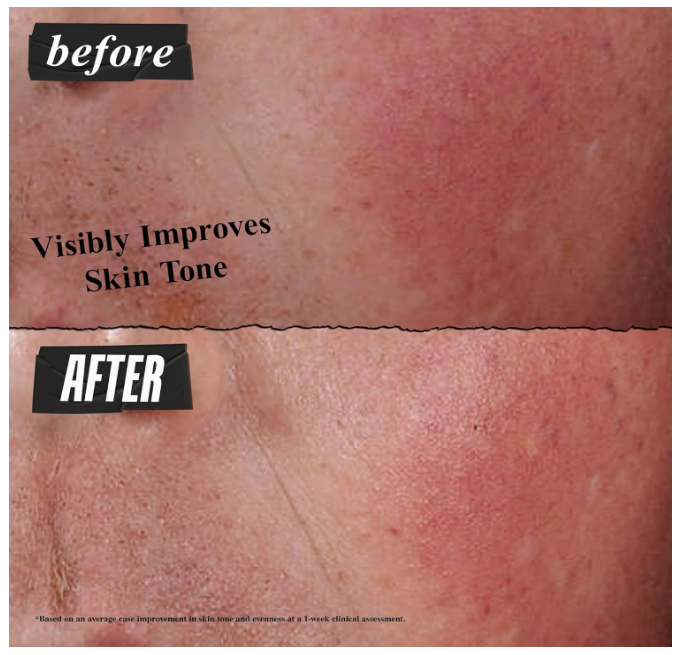 Khiel's Ultra Facial Advanced Repair Barrier Cream Suitable For Dry Skin Prone To Distress and Discomfort 1 fl oz