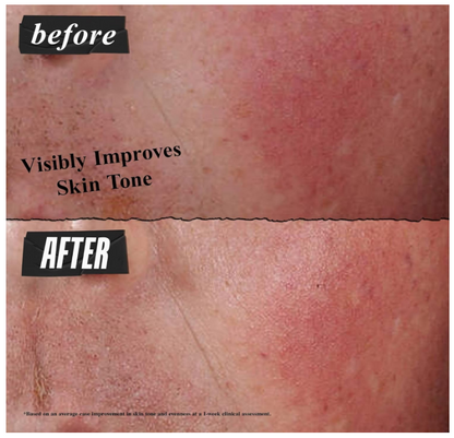 Khiel's Ultra Facial Advanced Repair Barrier Cream Suitable For Dry Skin Prone To Distress and Discomfort 1 fl oz